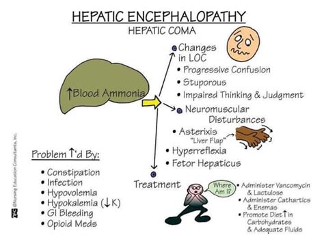 Hepatic Encephalopathy Pathophysiology