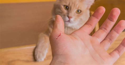 Cat scratch disease, cat scratch fever causes, symptoms, diagnosis ...