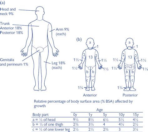 Burn Estimation Chart