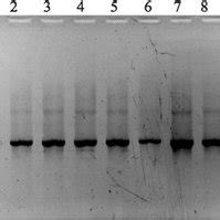 PCR-analysis of the recombinant strains. M marker; 1–10—PCR products of... | Download Scientific ...