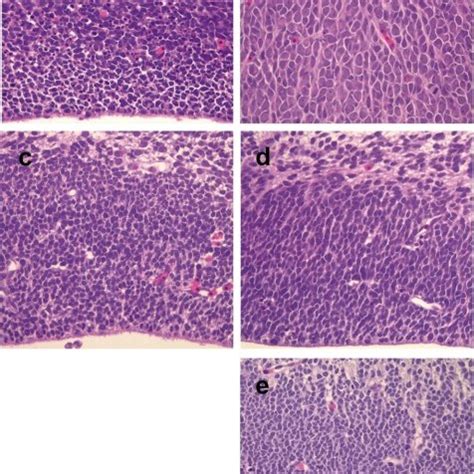 Histology of the telencephalon (a), diencephalon (b), mesencephalon... | Download Scientific Diagram