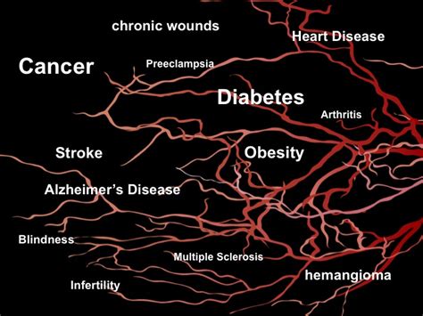 Angiogenesis | The Angiogenesis Foundation