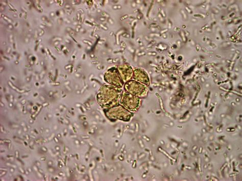 Blastocystis Infection