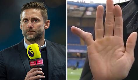 Pics: Ex-Premier League stopper Rob Green explains how he mangled his little finger in goals ...