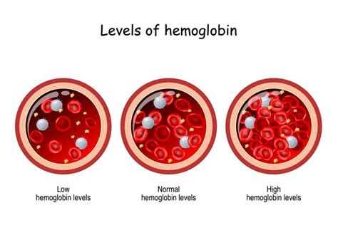 How Hemoglobin Levels Affect Your Health - Facty Health