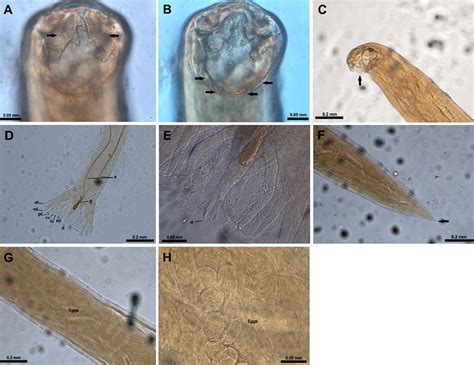 Ancylostoma Braziliense Morphology