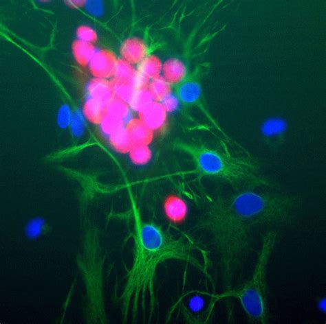 NeuN Monoclonal Antibody (1B7) (MA5-33103)