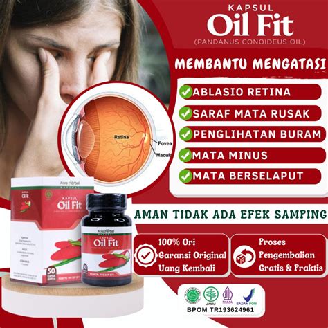 Jual Obat Ablasio Retina Saraf Mata Rusak Lemah Mata Penglihatan Buram Mata Kedutan Mata Ptosis ...