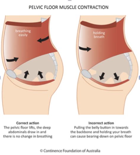 PELVIC FLOOR ISSUES?? IT MAY BE THAT YOU HAVE AN OVERACTIVE ONE RATHER THAN IT BEING WEAK | Health2u