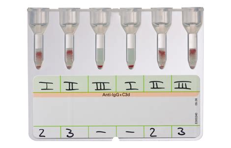 Antibody Screening | DiaHem