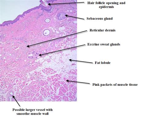 Dermpath Made Simple - Neoplastic: Introduction to skin histopathology