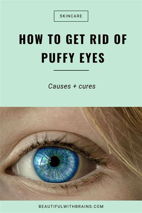 What Causes Puffy Eyes (And How To Treat Them)? – Beautiful With Brains