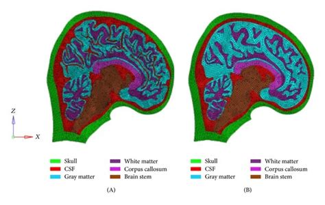 The development process of the models with and without gyri and sulci.... | Download Scientific ...