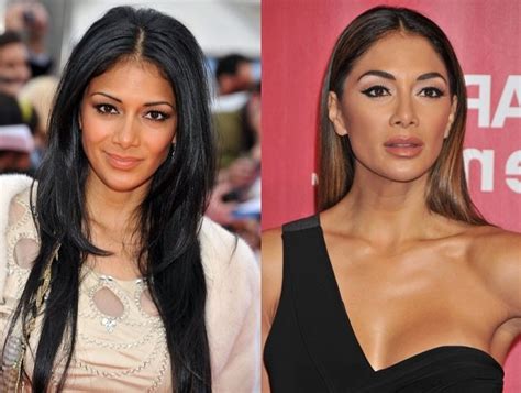 Nicole Scherzinger Before and After Plastic Surgery: Nose, Boobs, Face