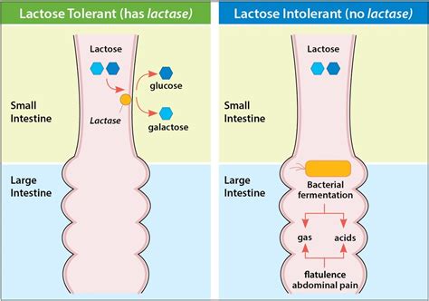 Various Sources Of Calcium For Lactose Intolerant Children, Causes, Types and Symptoms