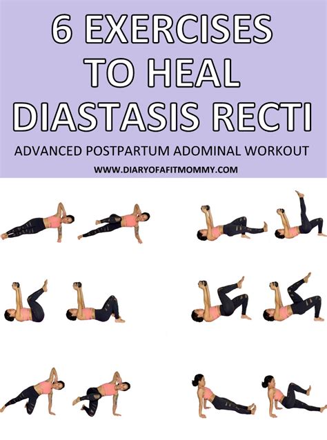 6 Exercises to Fix & Heal Diastasis Recti | ADVANCED Postpartum ...