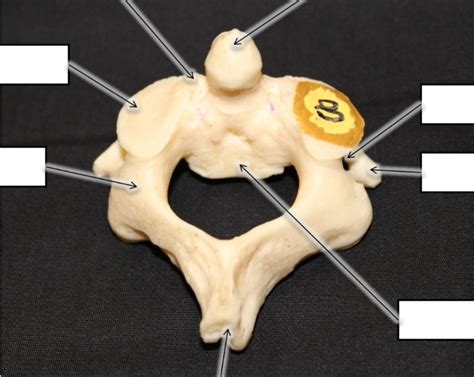 Axis Bone Diagram | Quizlet