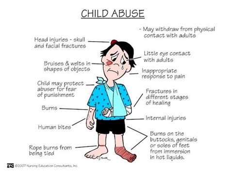 Types of Child Abuse and Neglect - Pediatrics