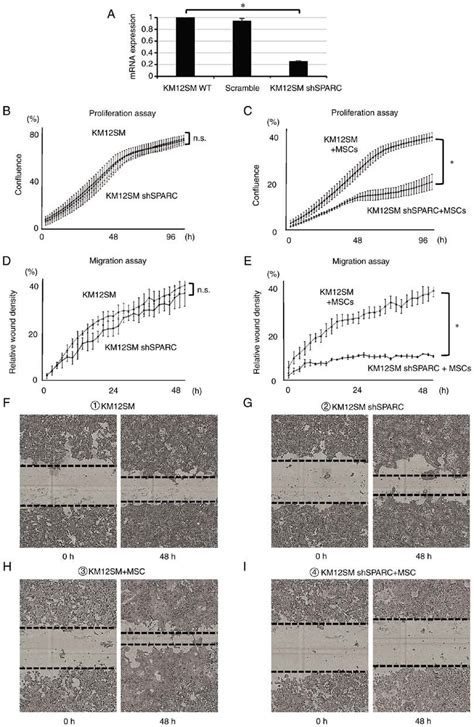 Expression levels and function of SPARC in CRC. (A) Gene expression ...