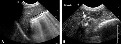 Dog Ultrasound Images : The sound waves generated by the ultrasound are ...