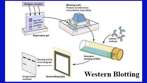 Western blotting- Introduction, Principle and Applications