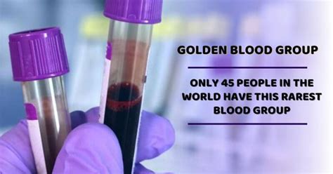 Golden Blood Group: Everything About This Rarest Blood Group In The World You Should Know