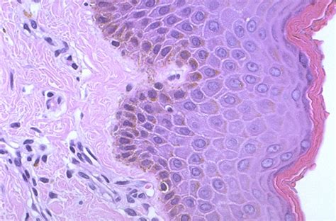 Normal Histology