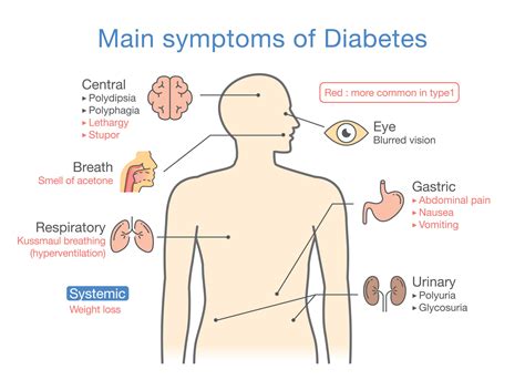 Type 1 Diabetes - Diabetes & Endocrine Treatment Specialists