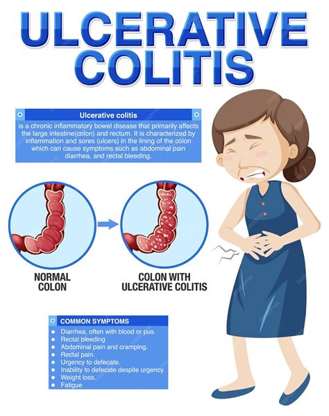 Infografía de los síntomas de la colitis ulcerosa | Vector Premium