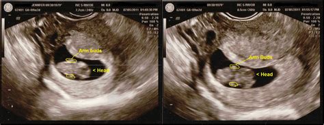 Early Ultrasound 9 weeks 2 days | Coolest Family on the Block