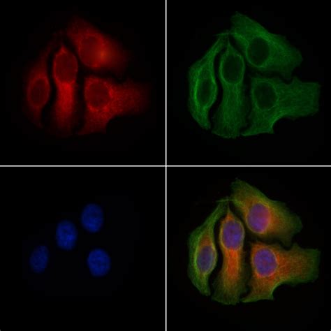 MCP-1 Antibody (PA5-115555)