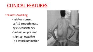 Cold abscess | PPT