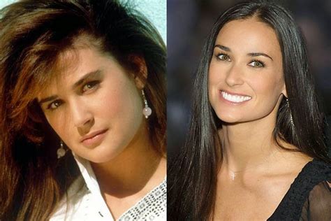 Chatter Busy: Demi Moore Plastic Surgery