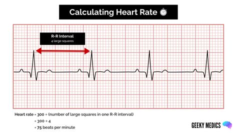 Ecg Cardiology Online Ecg Analysis Heart Rate And Inter Beat ...