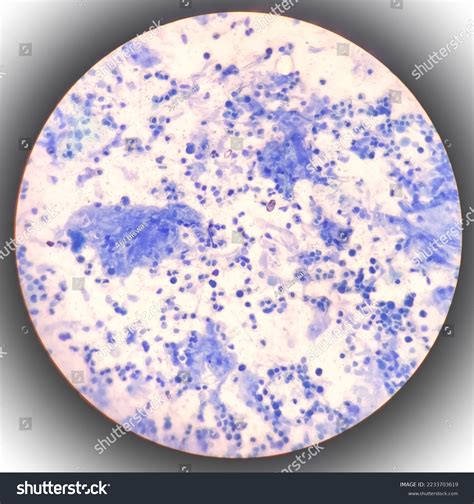 Streptococcus Pneumoniae Pus Cells Sputum Smear Stock Photo 2233703619 | Shutterstock