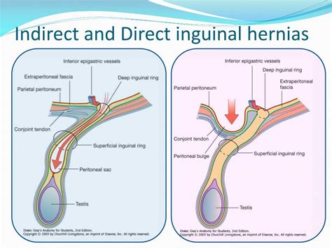 PPT - The anterolateral abdominal wall and peritoneum PowerPoint Presentation - ID:757010