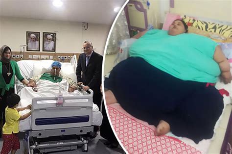 World's fattest woman loses 38 STONE after shock weight loss surgery ...