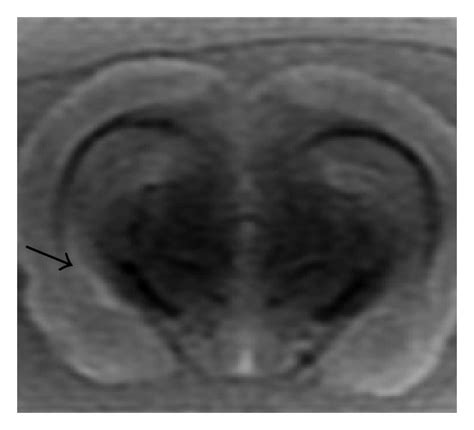 The appearance of lesion site in each group observed with MRI scanning... | Download Scientific ...