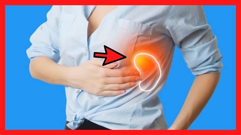 Natural remedies for Enlarged Spleen , splenomegaly - YouTube