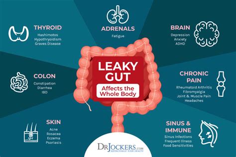 Intestinal Permeability, Histamine, and Leaky Gut Functional Lab Markers