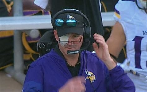 Mike Zimmer got eye patch jokes from Vikings players | Larry Brown Sports