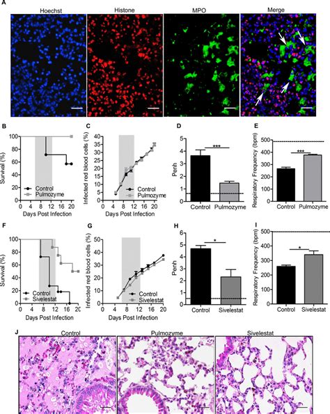 Recombinant human DNase 1 (Pulmozyme) and an elastase inhibitor ...