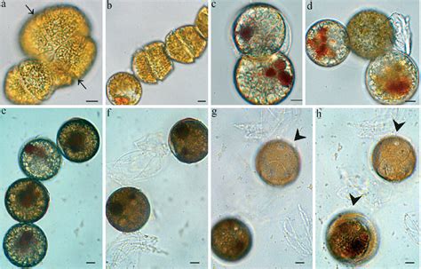 Figure 1 from New life-cycle stages of Gymnodinium catenatum ...