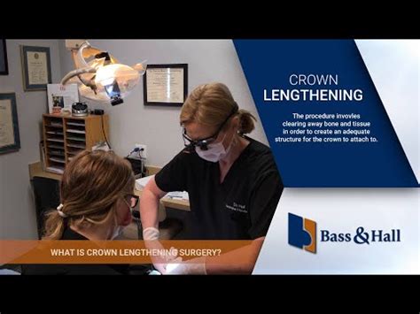 What is Crown Lengthening Surgery? | Bass and Hall Dental Implant and Periodontal Partners, LLP