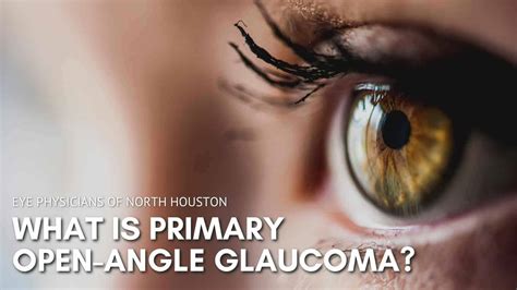 What is Primary Open-Angle Glaucoma? - Eye Physicians of North Houston ...