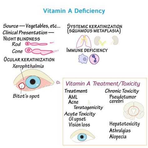 Pathology Glossary: Nutritional Disorders: Fat Soluble Vitamins ...