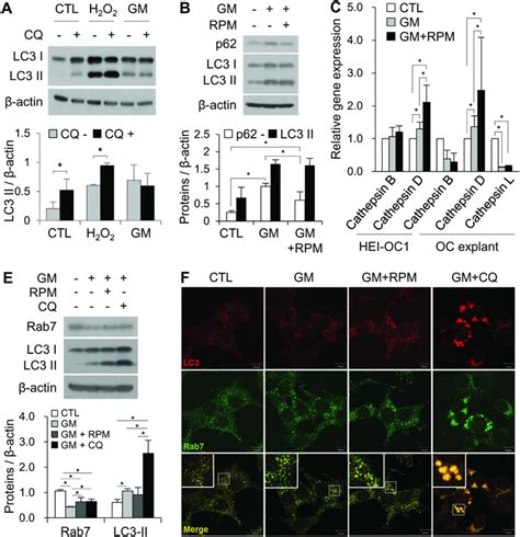 The autophagy inducer RPM enhances autophagic flux in auditory cells ...