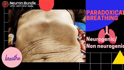 Paradoxical breathing pattern / Diaphragmatic paradox #paradoxicalrespiration # ...