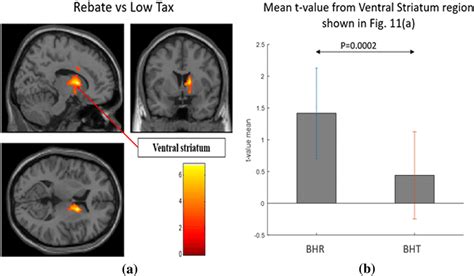 (a) The Ventral striatum showed significant (p | Download Scientific Diagram