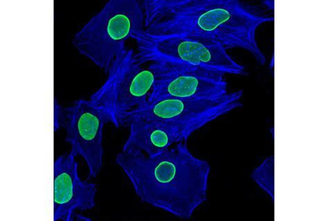 Alexa Fluor® 647 Phalloidin | Cell Signaling Technology